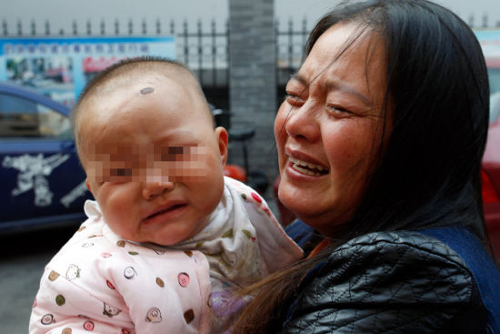 В Китае в теле годовалой девочки были найдены 16 иголок