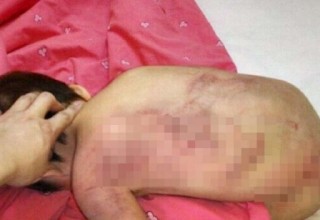 В Китае арестован мужчина, посылавший фото избитой дочери бывшей жене